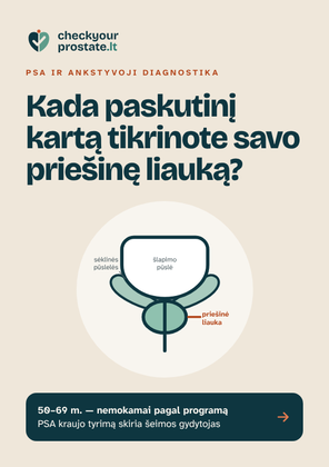 Priekis: Lankstinukas „Kada paskutinį kartą tikrinote savo priešinę liauką?“